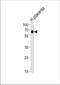 Serine/Threonine Kinase 39 antibody, TA302234, Origene, Western Blot image 