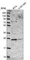 Golgi SNAP Receptor Complex Member 2 antibody, PA5-65534, Invitrogen Antibodies, Western Blot image 