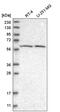 Phenylalanine Hydroxylase antibody, HPA031642, Atlas Antibodies, Western Blot image 