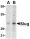 Zinc finger protein SNAI2 antibody, A01615, Boster Biological Technology, Western Blot image 