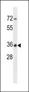 CPPED1 antibody, PA5-48930, Invitrogen Antibodies, Western Blot image 