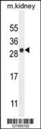 LY6/PLAUR Domain Containing 4 antibody, 55-135, ProSci, Western Blot image 