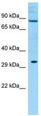 Kirre Like Nephrin Family Adhesion Molecule 2 antibody, TA339600, Origene, Western Blot image 
