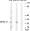 Mitochondrial Ribosomal Protein L47 antibody, GTX87919, GeneTex, Western Blot image 