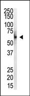 Protein Inhibitor Of Activated STAT 4 antibody, AP11253PU-N, Origene, Western Blot image 