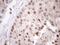 Zinc Finger Protein 200 antibody, NBP2-46423, Novus Biologicals, Immunohistochemistry paraffin image 