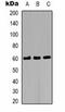 Matrilin 4 antibody, orb75176, Biorbyt, Western Blot image 