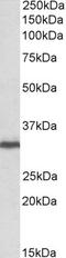 Receptor For Activated C Kinase 1 antibody, EB10690, Everest Biotech, Western Blot image 
