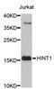 Hint antibody, STJ23945, St John