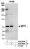 Dipeptidyl Peptidase 3 antibody, A305-365A, Bethyl Labs, Immunoprecipitation image 