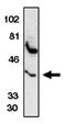 C-C Motif Chemokine Receptor 5 (Gene/Pseudogene) antibody, AP05101PU-N, Origene, Western Blot image 