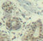 MDM2 Proto-Oncogene antibody, AP0293, ABclonal Technology, Immunohistochemistry paraffin image 