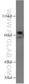 Zinc Finger Protein 74 antibody, 21843-1-AP, Proteintech Group, Western Blot image 