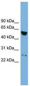 DEP Domain Containing 7 antibody, TA339912, Origene, Western Blot image 