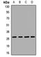 Phosphoglycerate mutase 1 antibody, orb412233, Biorbyt, Western Blot image 