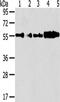 Cytochrome P450 Family 7 Subfamily A Member 1 antibody, CSB-PA646965, Cusabio, Western Blot image 