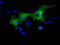 L1 Cell Adhesion Molecule antibody, LS-C115423, Lifespan Biosciences, Immunofluorescence image 