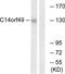 Spectrin Repeat Containing Nuclear Envelope Family Member 3 antibody, TA311709, Origene, Western Blot image 