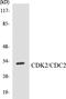 Cyclin Dependent Kinase 2 antibody, EKC1108, Boster Biological Technology, Western Blot image 