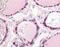 Phosphodiesterase 1C antibody, MBS395732, MyBioSource, Immunohistochemistry paraffin image 