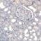 Neuroepithelial Cell Transforming 1 antibody, NBP2-46648, Novus Biologicals, Immunohistochemistry paraffin image 