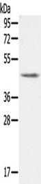 Phospholipid Transfer Protein antibody, TA350289, Origene, Western Blot image 