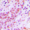Upstream stimulatory factor 2 antibody, LS-C352978, Lifespan Biosciences, Immunohistochemistry frozen image 