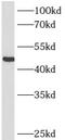 ST6 Beta-Galactoside Alpha-2,6-Sialyltransferase 1 antibody, FNab10130, FineTest, Western Blot image 