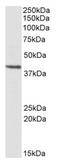 Proteasome Subunit Beta 7 antibody, AP21518PU-N, Origene, Western Blot image 