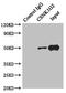 Casein Kinase 1 Gamma 2 antibody, LS-C675597, Lifespan Biosciences, Immunoprecipitation image 