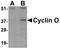 Cyclin O antibody, LS-B616, Lifespan Biosciences, Western Blot image 