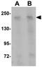 Coiled-Coil Domain Containing 88A antibody, GTX85215, GeneTex, Western Blot image 