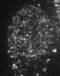 Chromobox 1 antibody, 70-223, BioAcademia Inc, Immunofluorescence image 