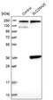 CAC antibody, PA5-53508, Invitrogen Antibodies, Western Blot image 