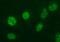 Ankyrin Repeat Domain 49 antibody, MA5-26333, Invitrogen Antibodies, Immunocytochemistry image 