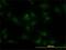 RAB7B, Member RAS Oncogene Family antibody, H00338382-M01, Novus Biologicals, Immunocytochemistry image 