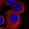 Transmembrane Protein 234 antibody, HPA015049, Atlas Antibodies, Immunofluorescence image 