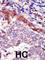Hormonally Up-Regulated Neu-Associated Kinase antibody, abx033787, Abbexa, Western Blot image 