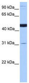 Saccharopine Dehydrogenase (Putative) antibody, TA335577, Origene, Western Blot image 