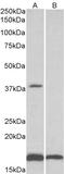 CD57 antibody, STJ72944, St John