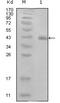 Protein E7 antibody, abx010679, Abbexa, Enzyme Linked Immunosorbent Assay image 