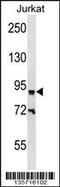 Zinc Finger Protein 780B antibody, 58-393, ProSci, Western Blot image 