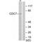 Cell division cycle 7-related protein kinase antibody, A01190, Boster Biological Technology, Western Blot image 