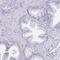 Sperm equatorial segment protein 1 antibody, HPA045936, Atlas Antibodies, Immunohistochemistry paraffin image 