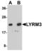 NADH:Ubiquinone Oxidoreductase Subunit B9 antibody, LS-B5082, Lifespan Biosciences, Western Blot image 