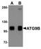 Autophagy Related 9B antibody, TA319026, Origene, Western Blot image 