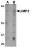 LIMP II antibody, LS-C53322, Lifespan Biosciences, Western Blot image 