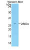 Mannan Binding Lectin Serine Peptidase 2 antibody, LS-C303432, Lifespan Biosciences, Western Blot image 