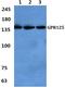 Probable G-protein coupled receptor 125 antibody, PA5-75663, Invitrogen Antibodies, Western Blot image 