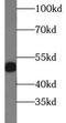 Placenta growth factor antibody, FNab06440, FineTest, Western Blot image 